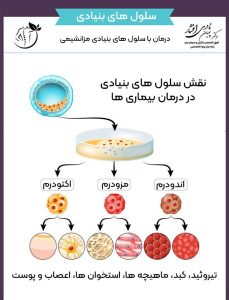 458 Stem Cell نقش سلول های بنیادی در درمان انواع بیماری ها در اصفهان و تهران Therapy